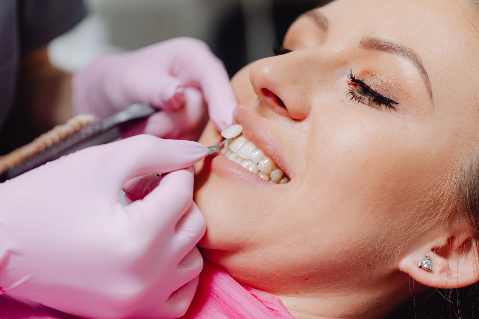 Cosmetic dental treatment at Willow Creek Dental